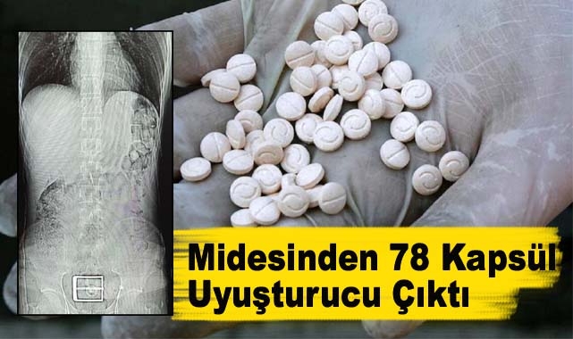 Midesinden 78 Kapsül Uyuşturucu Çıktı